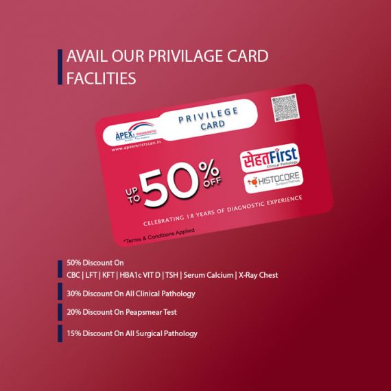 privilege card home banner